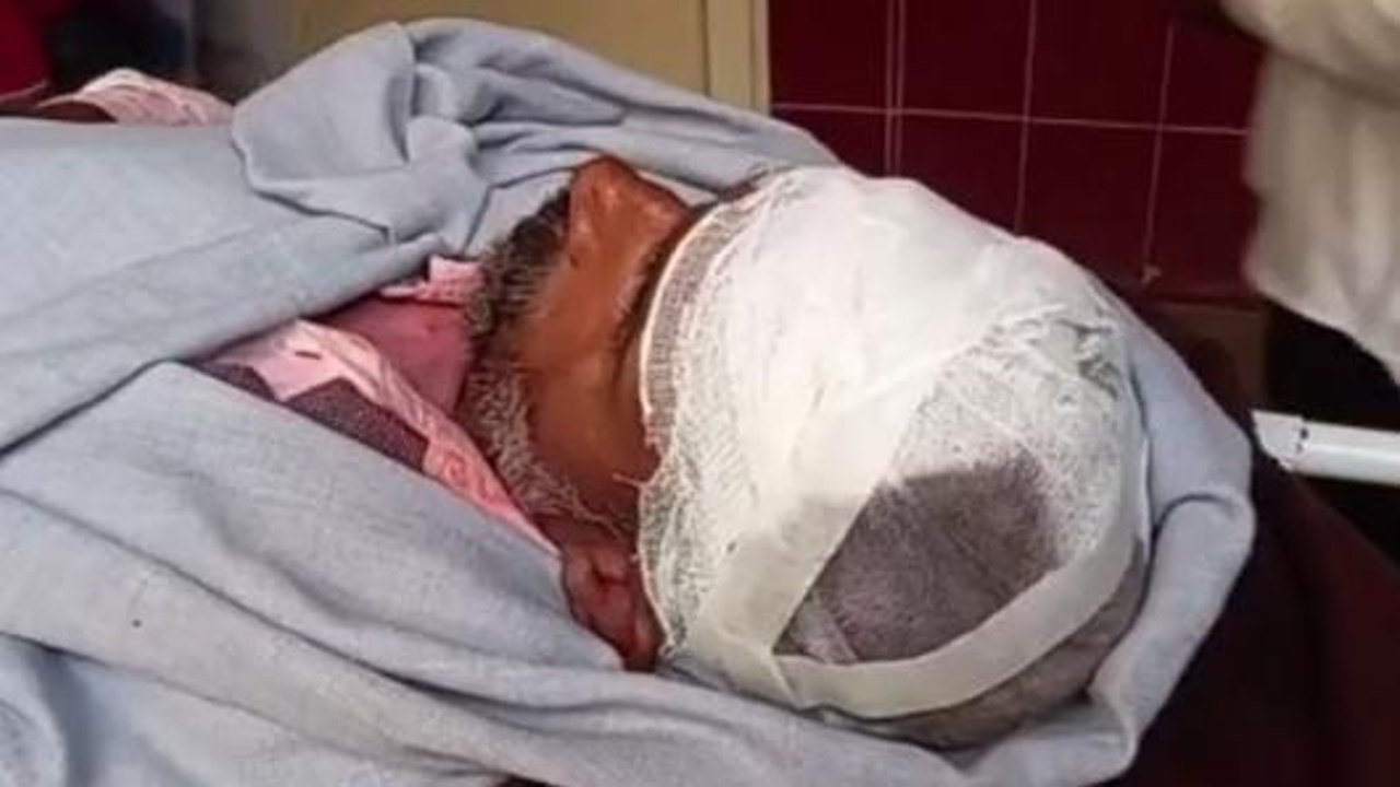 मुरादाबाद:गाली गलौज का विरोध करना ग्रामीण को पड़ा भारी,शराबियों ने की मारपीट
