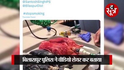 बिलासपुर पुलिस ने वीडियो शेयर कर बताया, सिगरेट के धुएं का फेफड़ों पर ऐसा होता है असर!