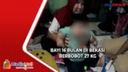 Alami Obesitas, Bayi 16 Bulan di Bekasi Berbobot 27 Kg
