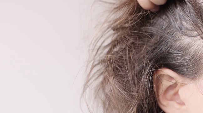 7 Ways To Regrow Thinning Hair