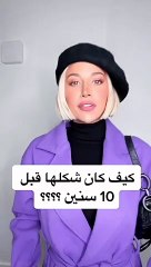 مراحل تغير ملامح مودل روز في 10 سنوات