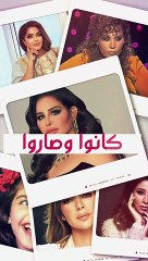 ديمة قندلفت قبل وبعد عمليات التجميل