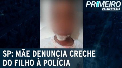 Mãe denuncia creche após filho se ferir e não ter atendimento