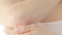 What Causes Scaly or Flaking Skin