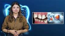 Loose Teeth Problem Symptoms क्या है, Reason चौकाने वाला | Boldsky