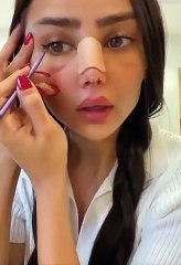 مروج الرحيلي نفسيتها تعبانه  من بعد أجراء عملية تجميل انفها