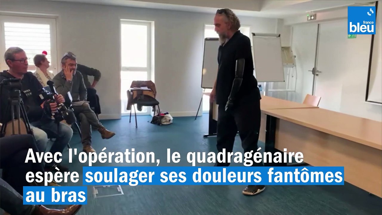 Bras bionique : un troisième patient opéré à Nantes