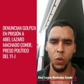 Denuncian golpiza  en prisión a Abel Lázaro  Machado Conde; preso político del 11-J