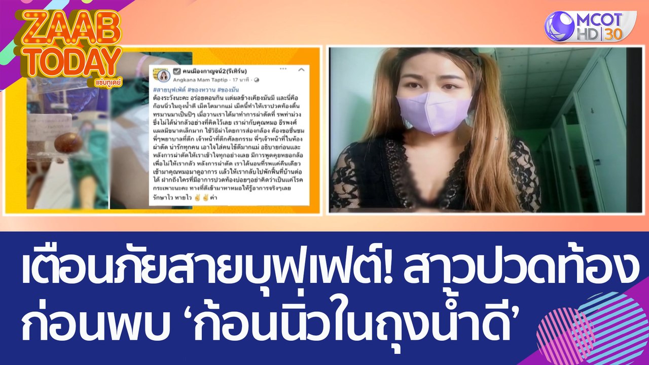 เตือนภัยสายบุฟเฟต์! สาวปวดท้องไม่หาย ก่อนพบก้อนนิ่วในถุงน้ำดี (16 มี.ค. 66) แซ่บทูเดย์