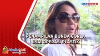 Intip Penampilan Baru Selegram Bunda Corla Usai Operasi Plastik