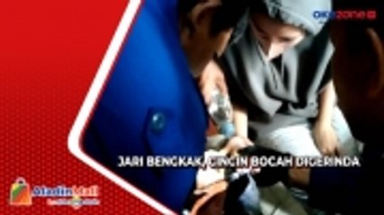 Akibat Membengkak, Evakuasi Cincin dari Jari Remaja ini Berlangsung Dramatis
