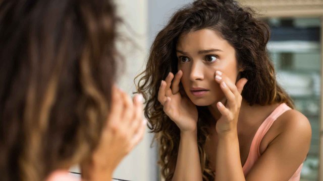 Geschwollene Augen: Mit diesen Hausmitteln wirst du sie los