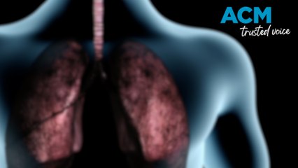 Australia has a vaping problem, but there's no easy health or political solution