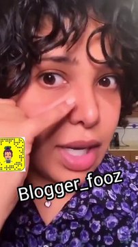 نجوم تبدلت ملامحهم بعد عمليات تجميل الأنف