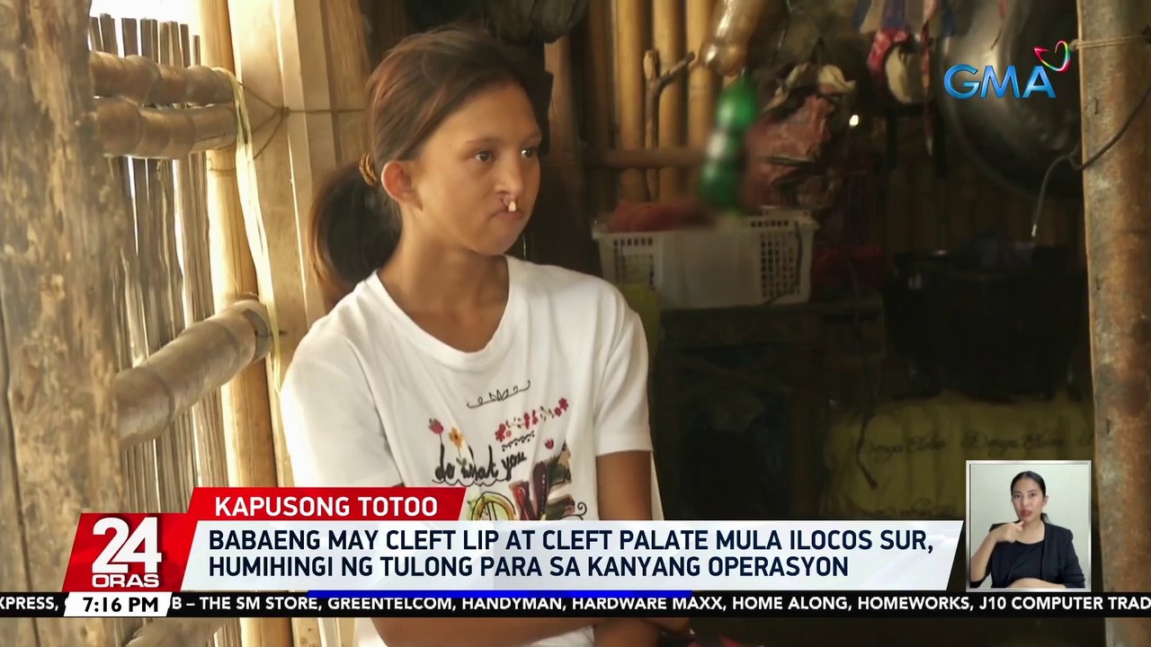 Babaeng may cleft lip at cleft palate mula Ilocos Sur, humihingi ng tulong para sa kanyang operasyon | 24 Oras