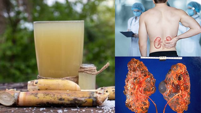 खाली पेट गन्ने का जूस पीने से क्या होता है । खाली पेट गन्ने का जूस पीने के फायदे । Boldsky