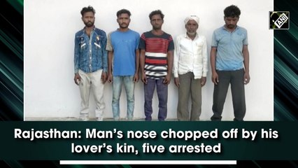Rajasthan: Man’s nose chopped off by his lover’s kin, five arrested