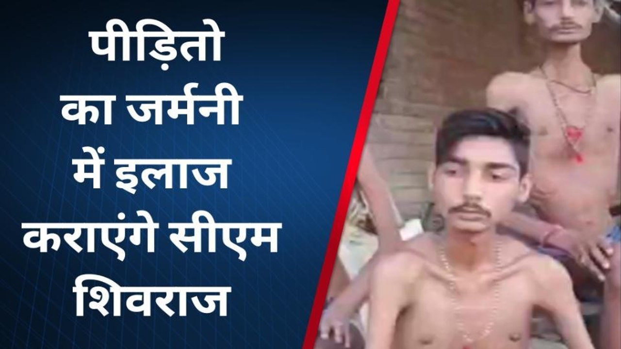 रीवा: अनजान बीमारी से पीड़ित परिवार के सभी लोगों का इलाज कराने का सीएम ने किया वादा