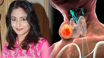 गले में गांठ होना इस गंभीर बीमारी का लक्षण, Lataa Saberwal को ये बीमारी जाने क्या Symptoms | Boldsky