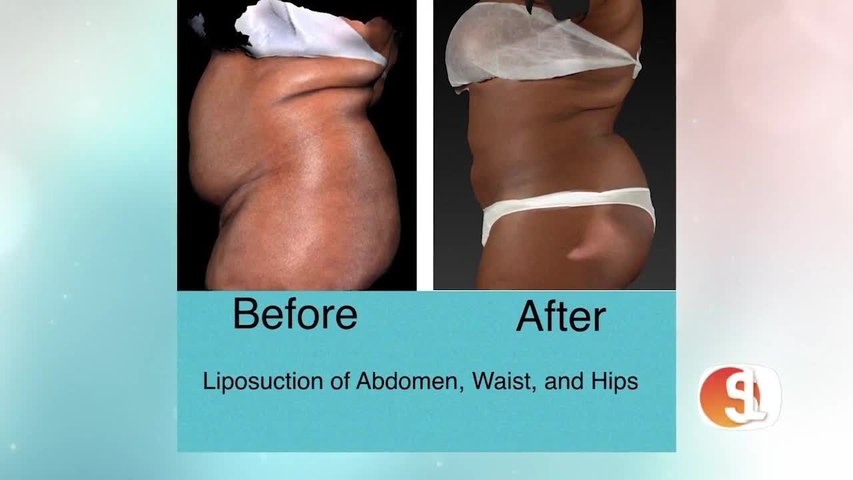 Tips to help you look and feel amazing in 2023 with Advanced Image Med Spa