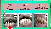 كيف تعرف عمر الماعز والغنم من اسنانها ؟