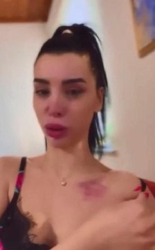 ALEYNA EROĞLU FUTBOLCU BATUHAN KARADENİZ'DEN ŞİDDET GÖRDÜĞÜNÜ İDDİA ETTİ