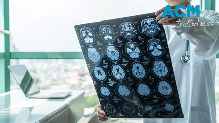 How to Recognize a Stroke Quickly with F.A.S.T. 🧠