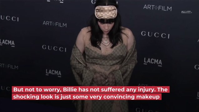 Billie Eilish Scares Fans: She's Covered In Blood!