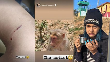 Sumbul Touqeer Ooty Trip पर Monkey के काटने के बाद Hospital Admit Video Viral | Boldsky