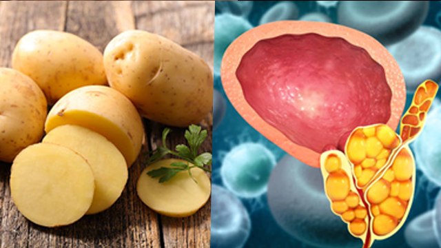 रोज आलू खाने से क्या होता है | Roj Aalu Khane se Kya Hota Hai | Boldsky