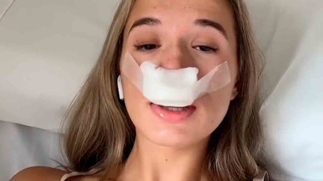 Fiz cirurgia plástica para que meus filhos herdassem meu novo nariz