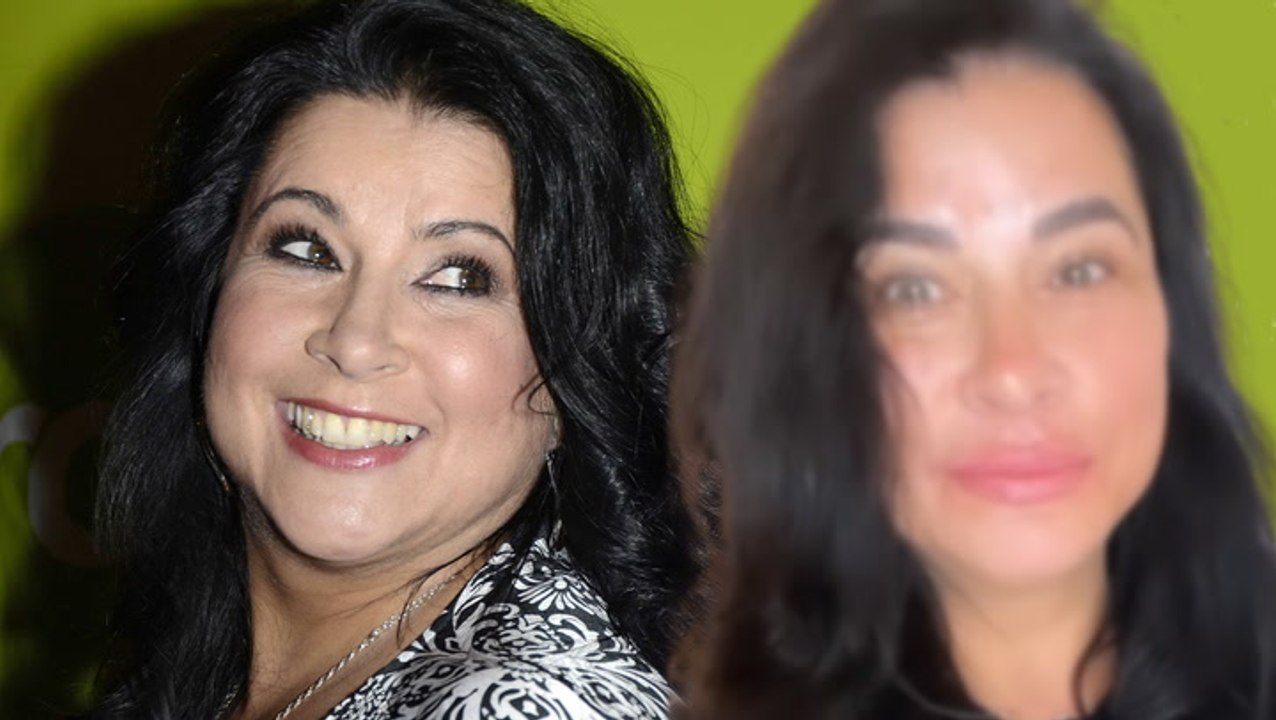 Iris Klein beim Beauty-Doc: Neue Lippen für die TV-Mama