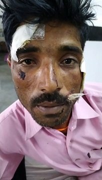 जिला अस्पताल में मरीजों के साथ चोरी की घटनाओं पर नहीं लग पा रही लगाम