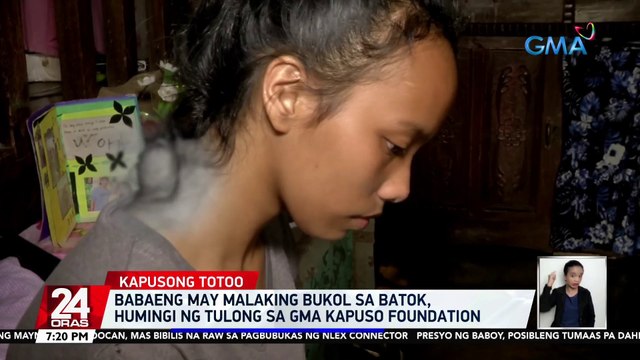 Babaeng may malaking bukol sa batok, humingi ng tulong sa GMA Kapuso Foundation | 24 Oras