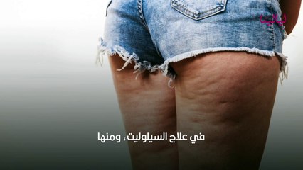 السيلوليت، أسبابه وعلاجه وخرافاته