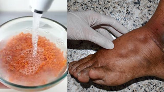 दाल पकाने से पहले पानी में भिगोना जरुरी क्यों ? । Dal Pakane Se Phele Pani Me Bhigona Jaruri Kyu