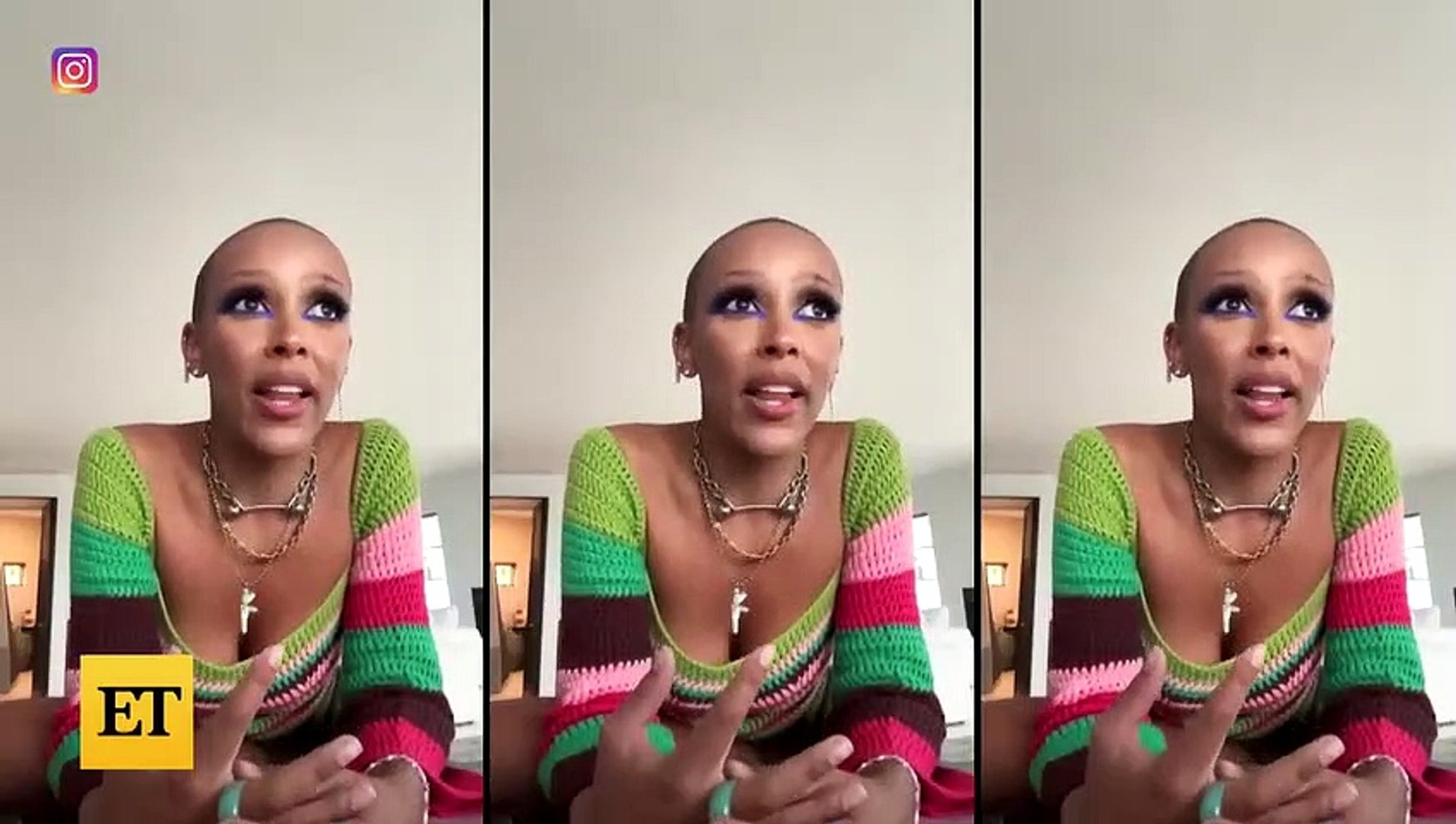 ⁣Doja Cat Reveals She Got Plastic Surgery