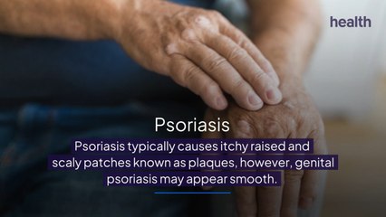 Conditions You Might Mistake For Genital Herpes