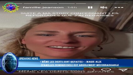 « Même les dents sont refaites » : Marie-Alix  (Familles nombreuses) est absolument méconnaissable