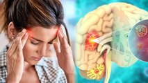 सर की नसों में दर्द क्यों होता है | Sir Ki Nason Mein Dard Kyu Hota Hai | Boldsky