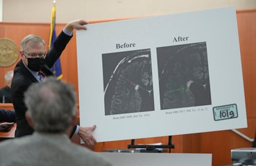 Gwyneth Paltrow’s lawyer brands neurologist ‘nerd’ at ski crash trial