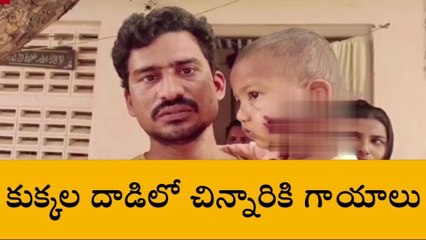 కృష్ణా జిల్లాలో చిన్నారిపై కుక్కల దాడి