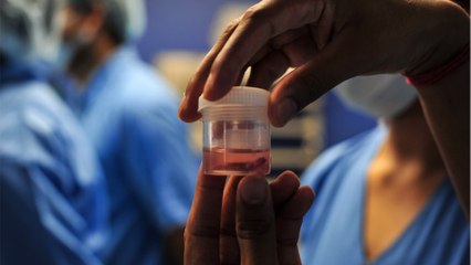 Fatal plant fungus infects man for first time and experts are on high alert, here's what you need to know