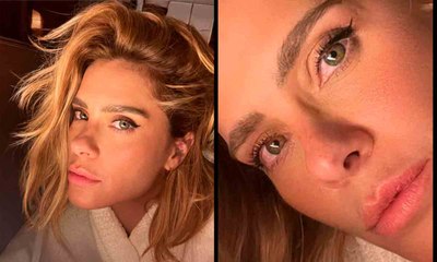 Biomédica analisa Carolina Dieckmann e diz se atriz fez botox ou preenchimento labial