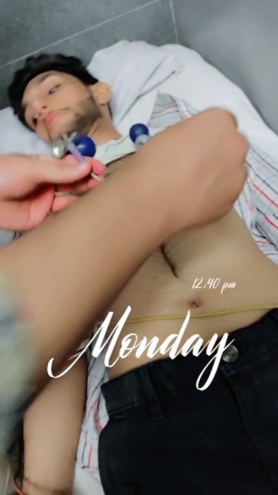 Performing ECG