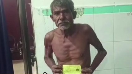 सुपौल: खाना मांगने पर कलयुगी पुत्र ने पिता के साथ की मारपीट, वृद्ध अस्पताल में