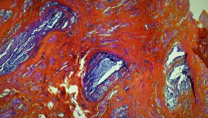 De Humani Corporis Fabrica Bande-annonce (EN)