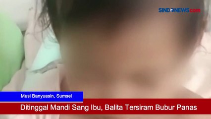 Ditinggal Mandi oleh Sang Ibu, Balita Tersiram Bubur Panas