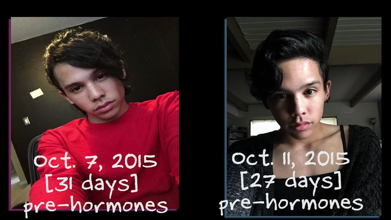 ONE YEAR ON HORMONES! MtF Transition Timeline