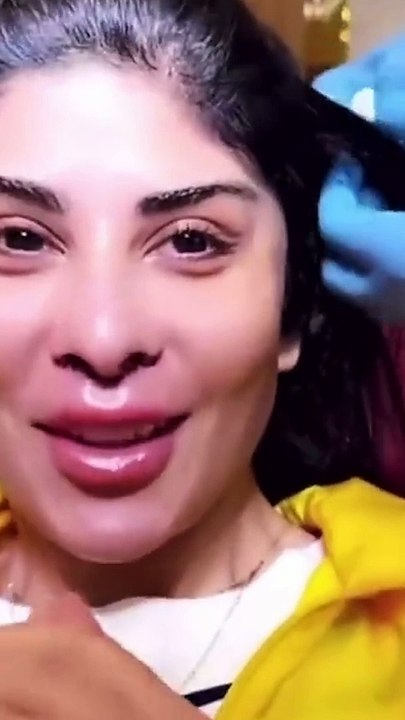 زارا البلوشي تخضع لعملية نحت الخصر وتستعرض جسدها